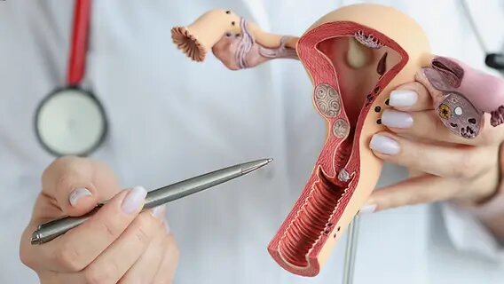ما هي لحمية الرحم: أسباب وأعراض وعلاج